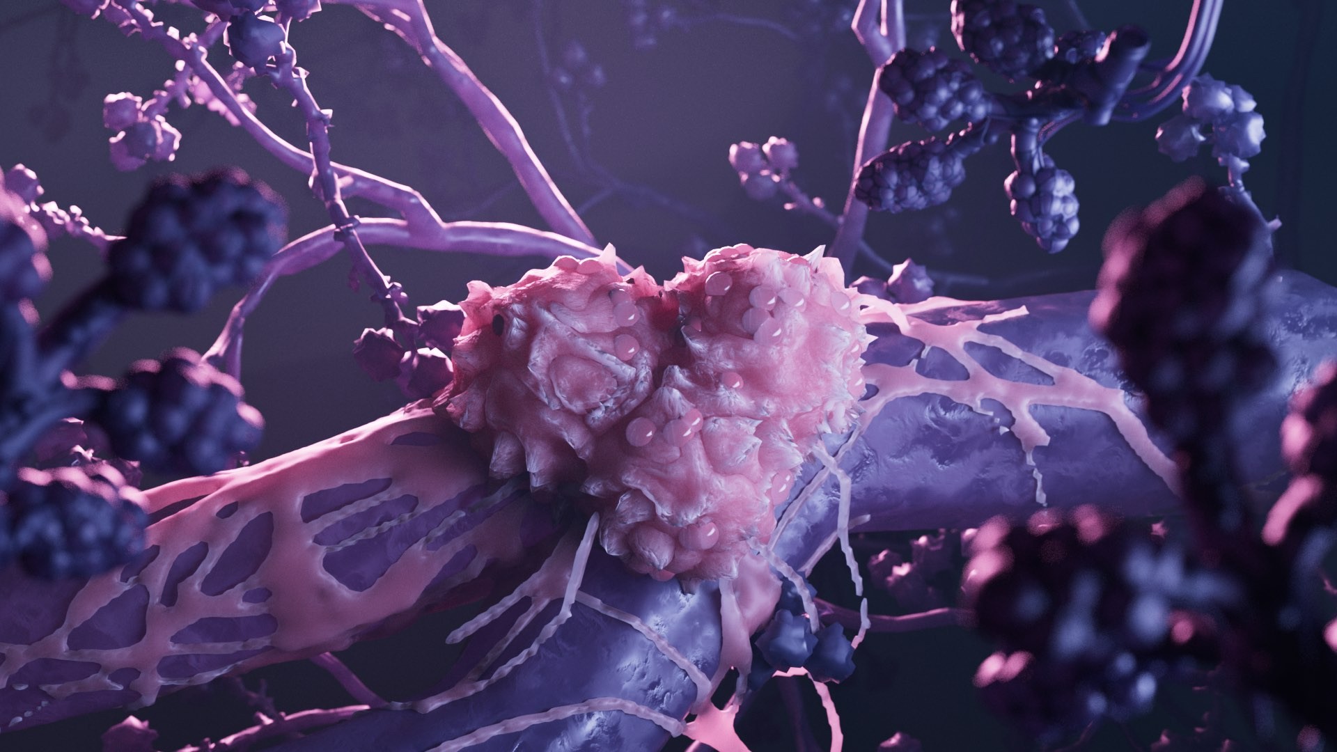 3d animation of Pink malignant tumour in the body.jpg